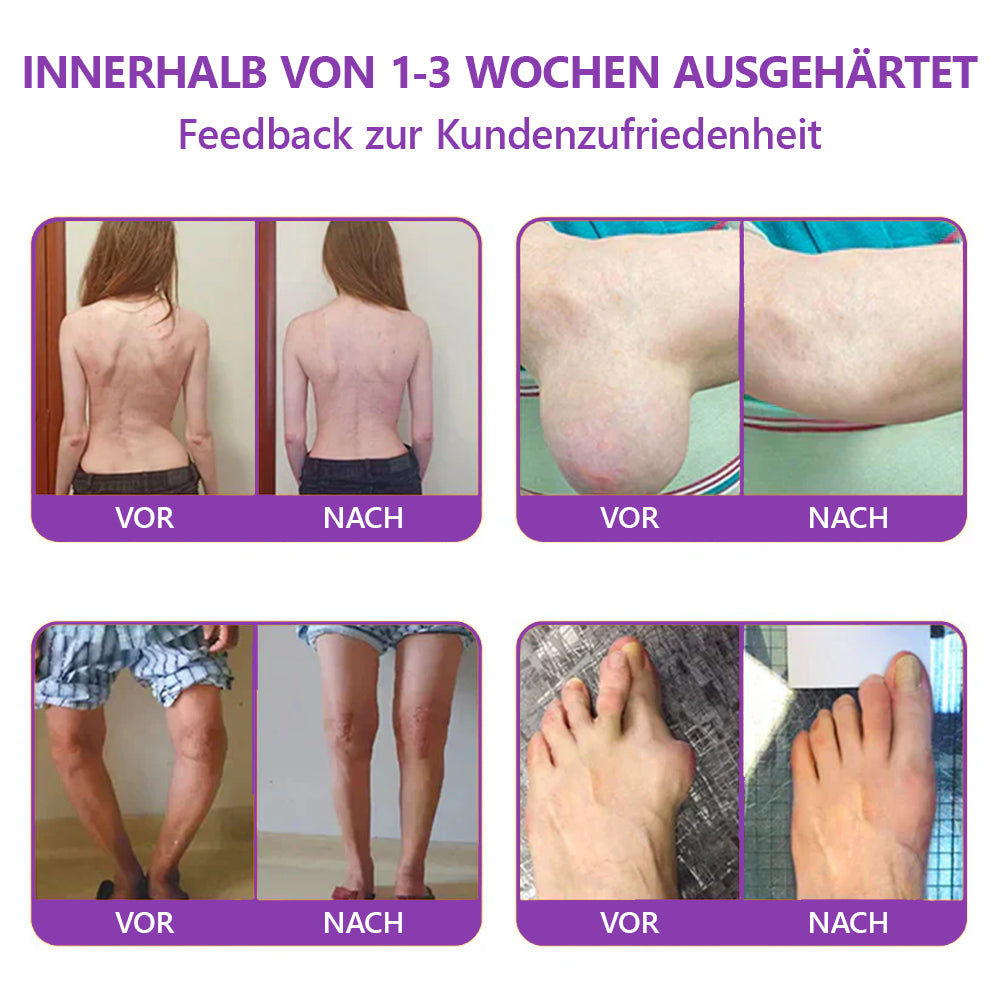 Offizieller Store: TLOPA® Hai-Knorpel Schmerzlinderndes Knochenerholungs-Gel👨⚕️ Von der BfArM zugelassen (5 Minuten Schmerzlinderung, 7 Tage zur Wiederherstellung der Gelenkbeweglichkeit, 4 Wochen für vollständige Heilung) 🔥