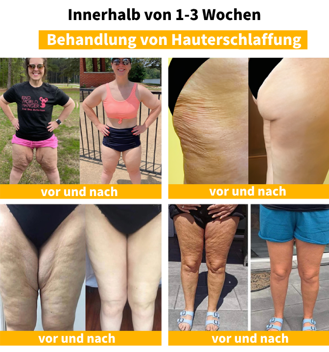 (letzter Tag: 80 % Rabatt)🔥Verabschieden Sie sich von Falten – LEFUN® Advanced Straffendes & Faltenreduzierendes Serum