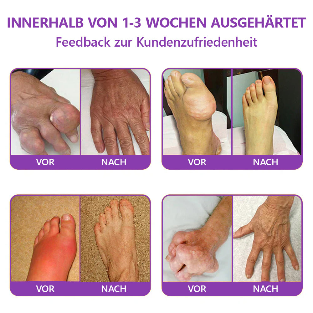 Offizieller Store: TLOPA® Hai-Knorpel Schmerzlinderndes Knochenerholungs-Gel👨⚕️ Von der BfArM zugelassen (5 Minuten Schmerzlinderung, 7 Tage zur Wiederherstellung der Gelenkbeweglichkeit, 4 Wochen für vollständige Heilung) 🔥