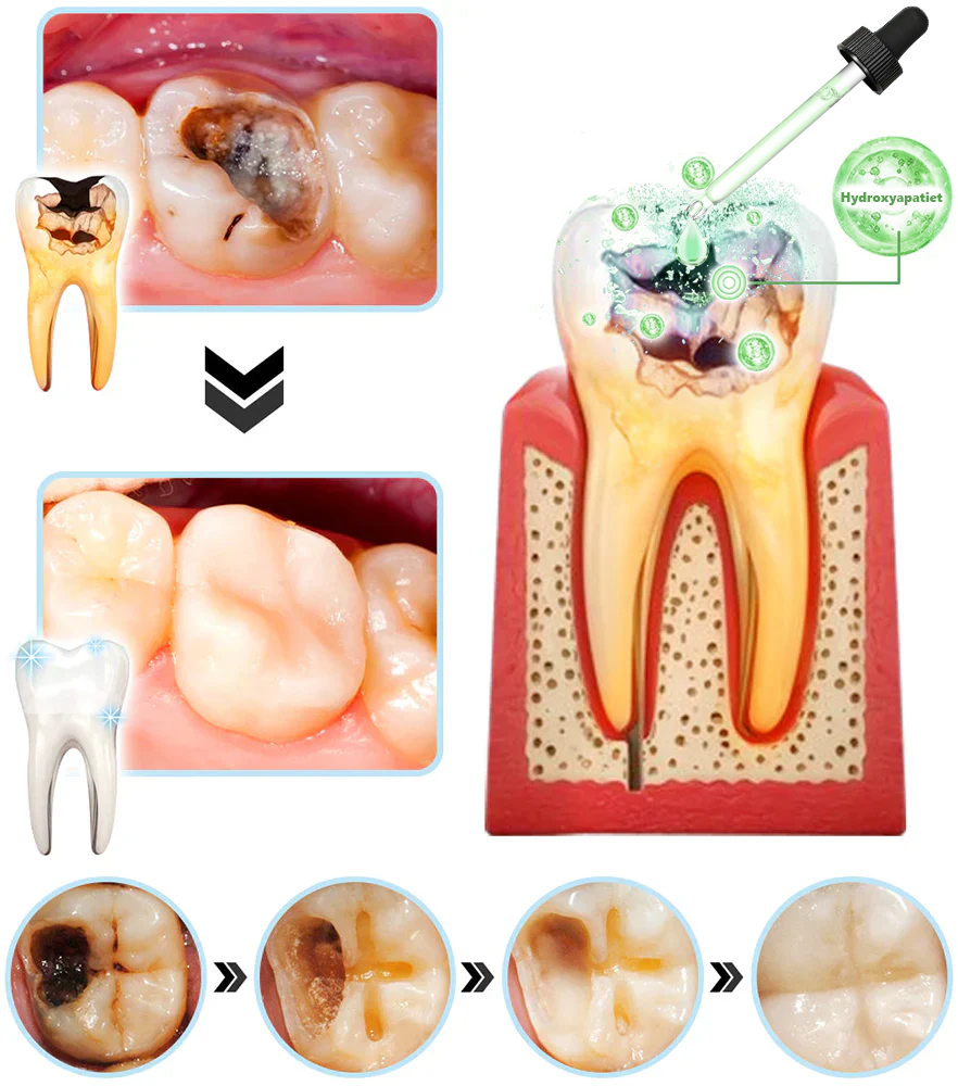𝐋𝗘𝑭𝐔𝐍® 𝐙𝐚𝐡𝐧𝐡𝐞𝐢𝐥𝐤𝐮𝐧𝐝𝐥𝐢𝐜𝐡𝐞 𝐄𝐬𝐬𝐞𝐧𝐳 𝐳𝐮𝐫 𝐫𝐞𝐠𝐞𝐧𝐞𝐫𝐚𝐭𝐢𝐯𝐞𝐧 𝐖𝐢𝐞𝐝𝐞𝐫𝐡𝐞𝐫𝐬𝐭𝐞𝐥𝐥𝐮𝐧𝐠 👑 Zugelassen vom BfArM 👨‍⚕️Wirksam bei Zahnfleischrückgang, Zahnstein, Karies, Zahnschmelzschäden, verfärbten Zähnen und mehr