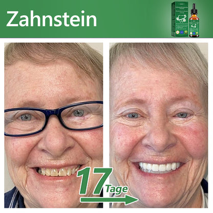 𝐋𝗘𝑭𝐔𝐍® 𝐙𝐚𝐡𝐧𝐡𝐞𝐢𝐥𝐤𝐮𝐧𝐝𝐥𝐢𝐜𝐡𝐞 𝐄𝐬𝐬𝐞𝐧𝐳 𝐳𝐮𝐫 𝐫𝐞𝐠𝐞𝐧𝐞𝐫𝐚𝐭𝐢𝐯𝐞𝐧 𝐖𝐢𝐞𝐝𝐞𝐫𝐡𝐞𝐫𝐬𝐭𝐞𝐥𝐥𝐮𝐧𝐠 👑 Zugelassen vom BfArM 👨‍⚕️Wirksam bei Zahnfleischrückgang, Zahnstein, Karies, Zahnschmelzschäden, verfärbten Zähnen und mehr