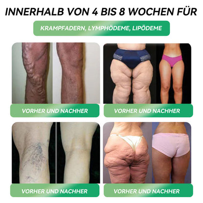 Empfohlen von deutschen Ärzten｜𝐋𝐞𝐫𝐜𝐞𝐚®👨‍⚕️ GLP-1 Orales Gewichtsreduktionsprogramm 👑 (Sichtbare Ergebnisse in nur 7 Tagen)  Geeignet für: Fettleibigkeit, Herz-Kreislauf-Gesundheit, Diabetes, Schlafapnoe, Darmgesundheit, Gelenkprobleme und mehr 🎗️