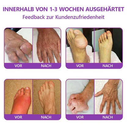 Offizieller Store: TLOPA® Hai-Knorpel Schmerzlinderndes Knochenerholungs-Gel👨‍⚕️ Von der BfArM zugelassen (5 Minuten Schmerzlinderung, 7 Tage zur Wiederherstellung der Gelenkbeweglichkeit, 4 Wochen für vollständige Heilung) 🔥