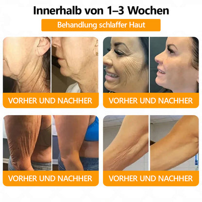 (letzter Tag: 80 % Rabatt)🔥Verabschieden Sie sich von Falten – LEFUN® Advanced Straffendes & Faltenreduzierendes Serum🔥